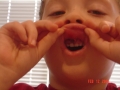 nick tooth surgery 2005